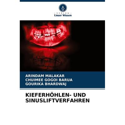 Kieferhöhlen- und Sinusliftverfahren, Taschenbuch von Arindam Malakar,Chuimee Gogoi Barua,Gourika Bhardwaj, Verlag Unser Wissen, 978-620-7-09576-6