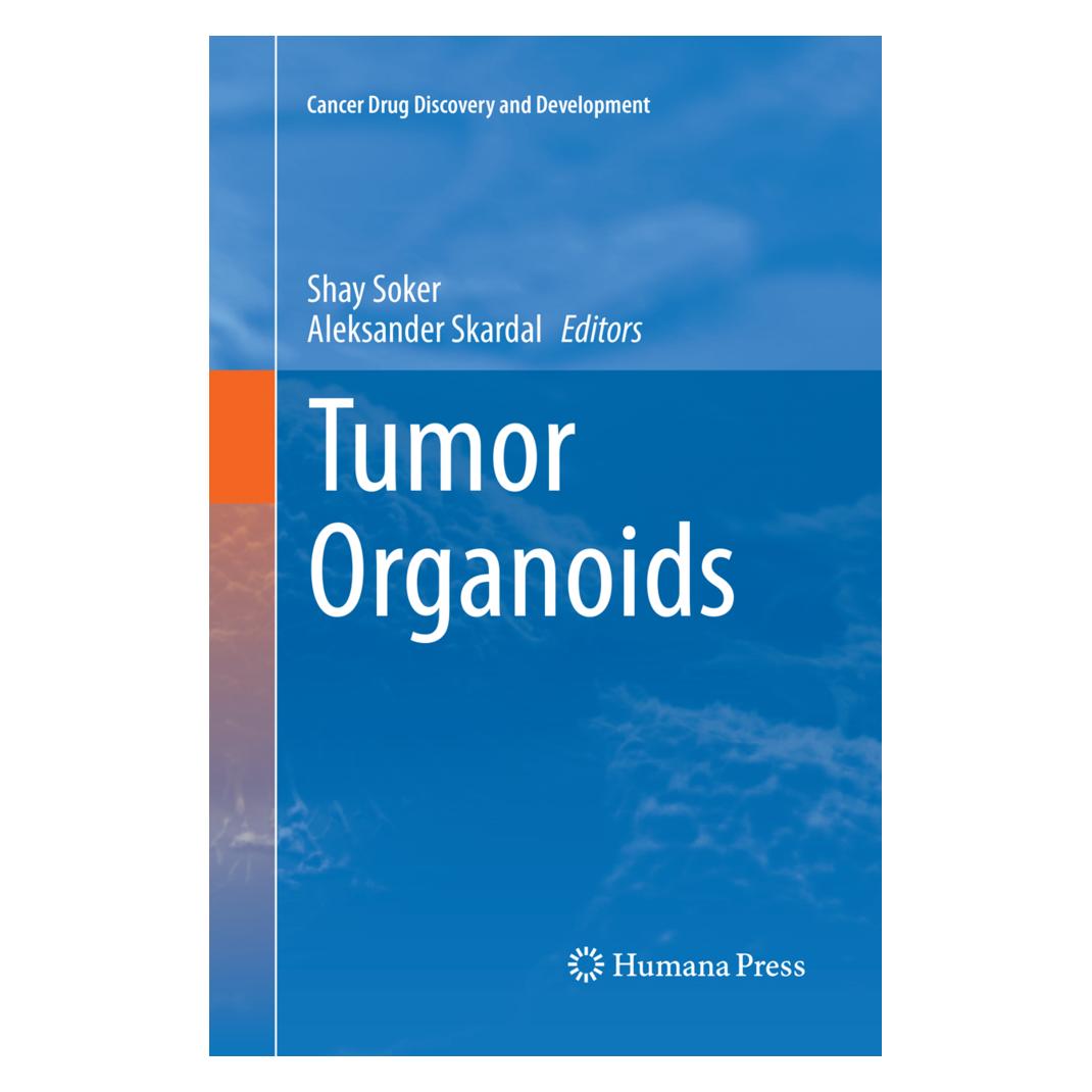 Springer Tumor Organoids (Englisch, Softcover, Aleksander Skardal, Shay Soker) (56052161)