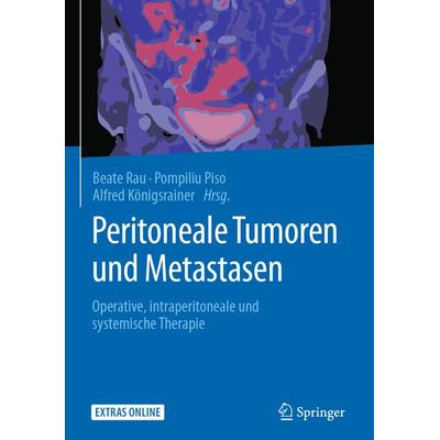 Peritoneale Tumoren und Metastasen, Gebundene Ausgabe von , Springer Berlin, 978-3-662-54499-0