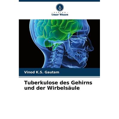 Tuberkulose des Gehirns und der Wirbelsäule, Taschenbuch von Vinod K. S. Gautam, Verlag Unser Wissen, 978-620-8-38063-2
