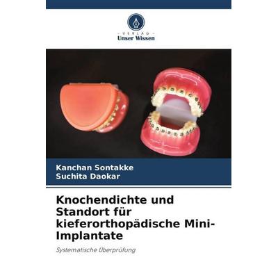 Knochendichte und Standort für kieferorthopädische Mini-Implantate, Taschenbuch von Kanchan Sontakke,Suchita Daokar, Verlag Unser Wissen,