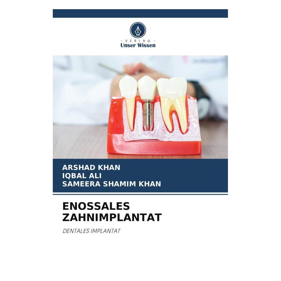 Unser Wissen Enossales Zahnimplantat (56915406)