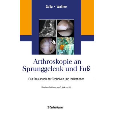 Arthroskopie an Sprunggelenk und Fuß, Gebundene Ausgabe von , Schattauer, 978-3-7945-2967-4