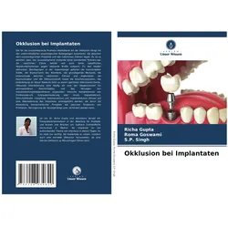 Okklusion bei Implantaten, Fachbücher von Roma Goswami, Richa Gupta, S. P. Singh