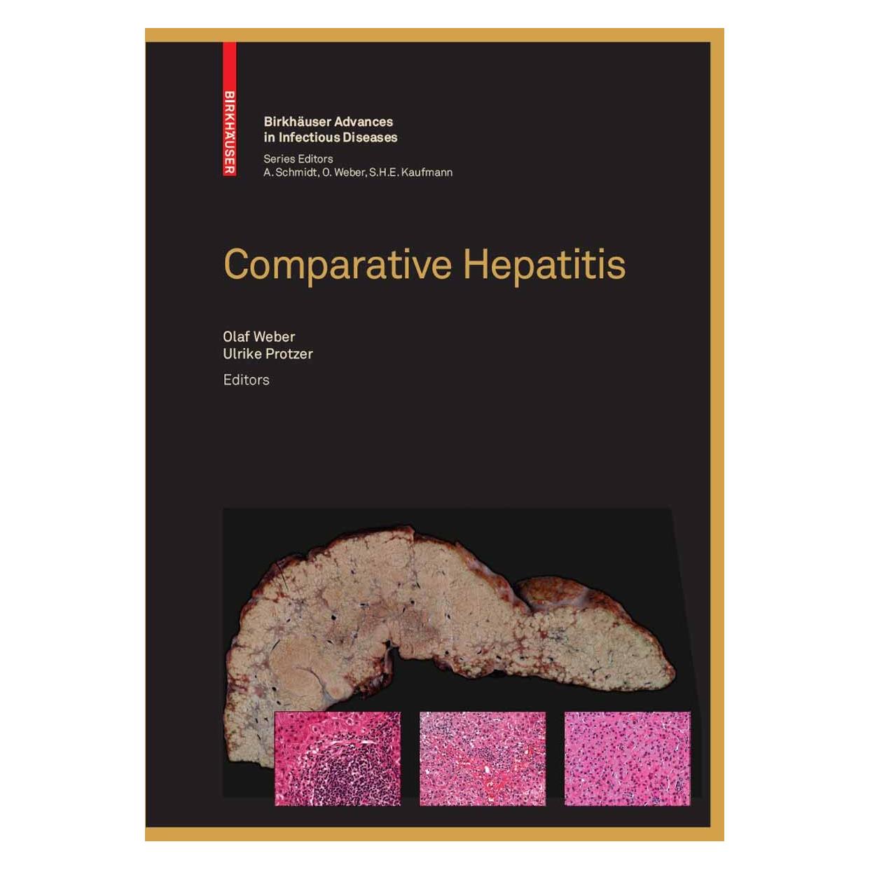 Springer Comparative Hepatitis (9783764385576)