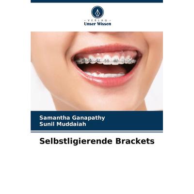 Selbstligierende Brackets, Taschenbuch von Samantha Ganapathy,Sunil Muddaiah, Verlag Unser Wissen, 978-620-7-54227-7