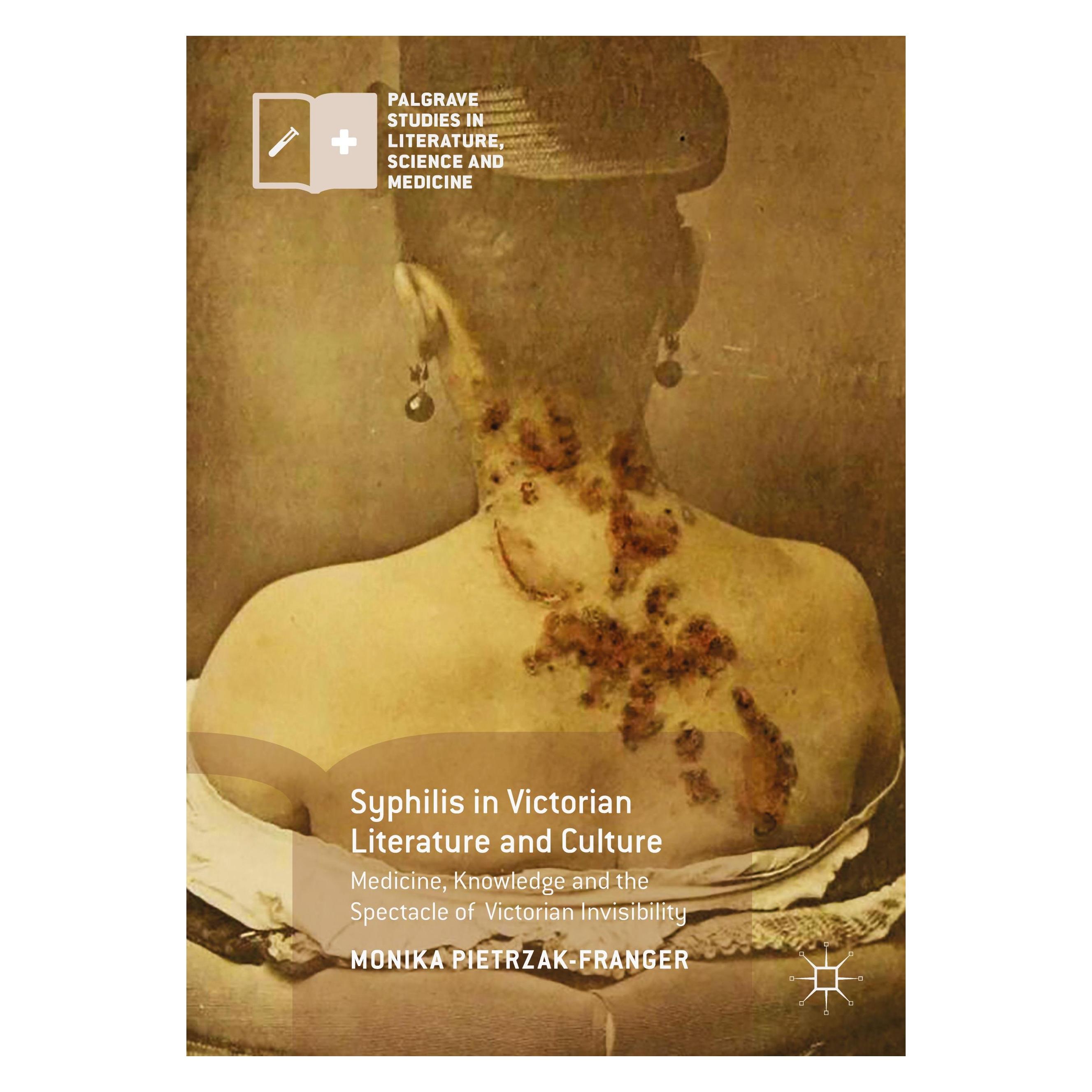 Springer Syphilis in Victorian Literature and Culture (Englisch, Hardcover, Monika Pietrzak-Franger) (9783319495347)
