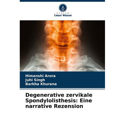Degenerative zervikale Spondylolisthesis: Eine narrative Rezension, Taschenbuch von Himanshi Arora,Juhi Singh,Barkha Khurana, Verlag Unser Wissen,