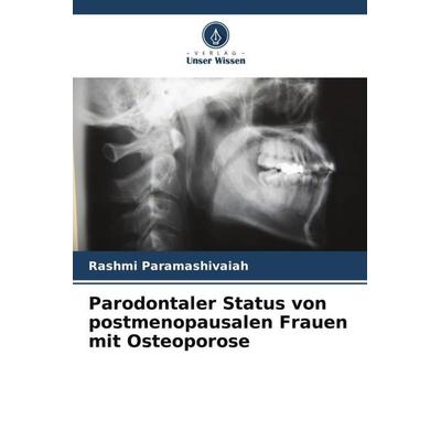 Parodontaler Status von postmenopausalen Frauen mit Osteoporose, Taschenbuch von Rashmi Paramashivaiah, Verlag Unser Wissen, 978-620-5-43841-1