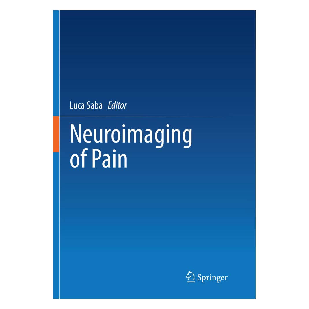 Springer Neuroimaging of Pain (Englisch, Softcover, Luca Saba) (55998351)