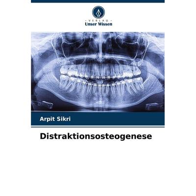 Distraktionsosteogenese, Taschenbuch von Arpit Sikri, Verlag Unser Wissen, 978-620-7-87643-3