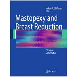 Mastopexy and Breast Reduction, Fachbücher von Melvin A. Shiffman