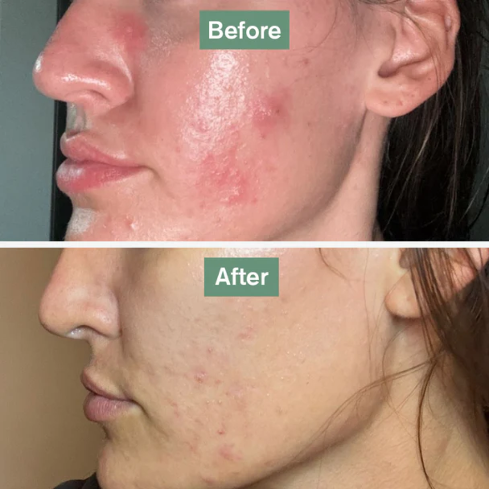 Dr. Vegan Complemento alimenticio Skin Saviour 60&nbsp;caps.