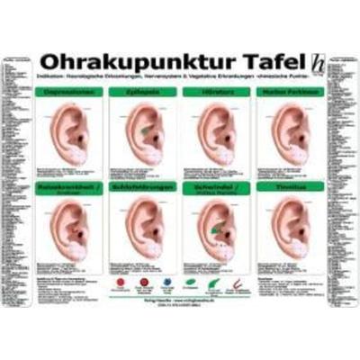 Ohrakupunktur Tafel - Indikation: Neurologische Erkrankungen, Nervensystem & Vegetative Erkrankungen, Sonstige von , Hawelka, Verlag,