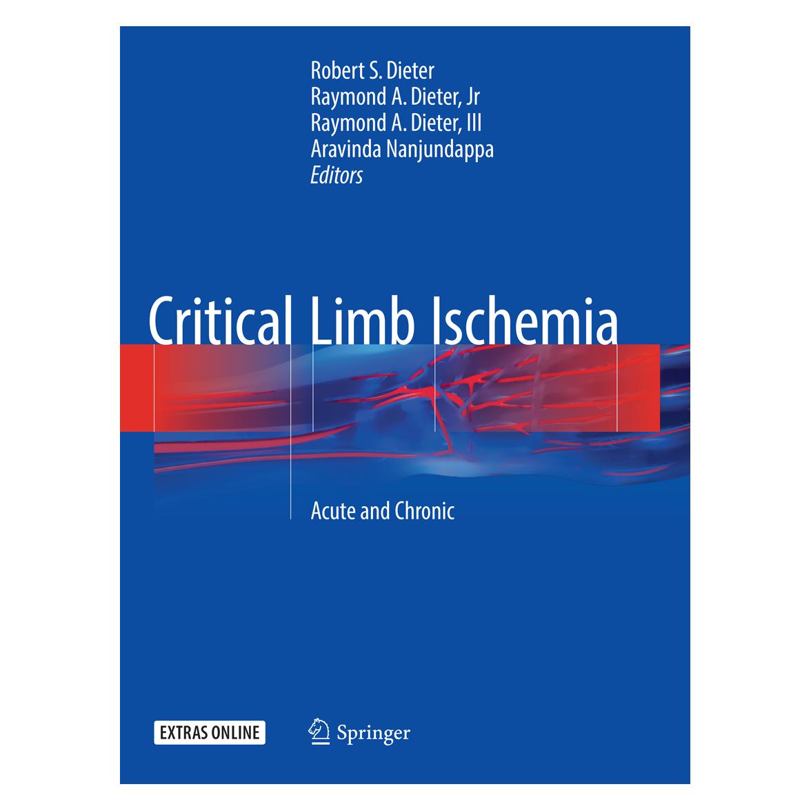 Springer Critical Limb Ischemia (Englisch, Softcover, Aravinda Nanjundappa, Raymond A. Dieter, Robert S Dieter) (56006512)