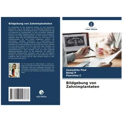 Bildgebung von Zahnimplantaten, Fachbücher von Poornima C, Balaji P, Samadrita Paul