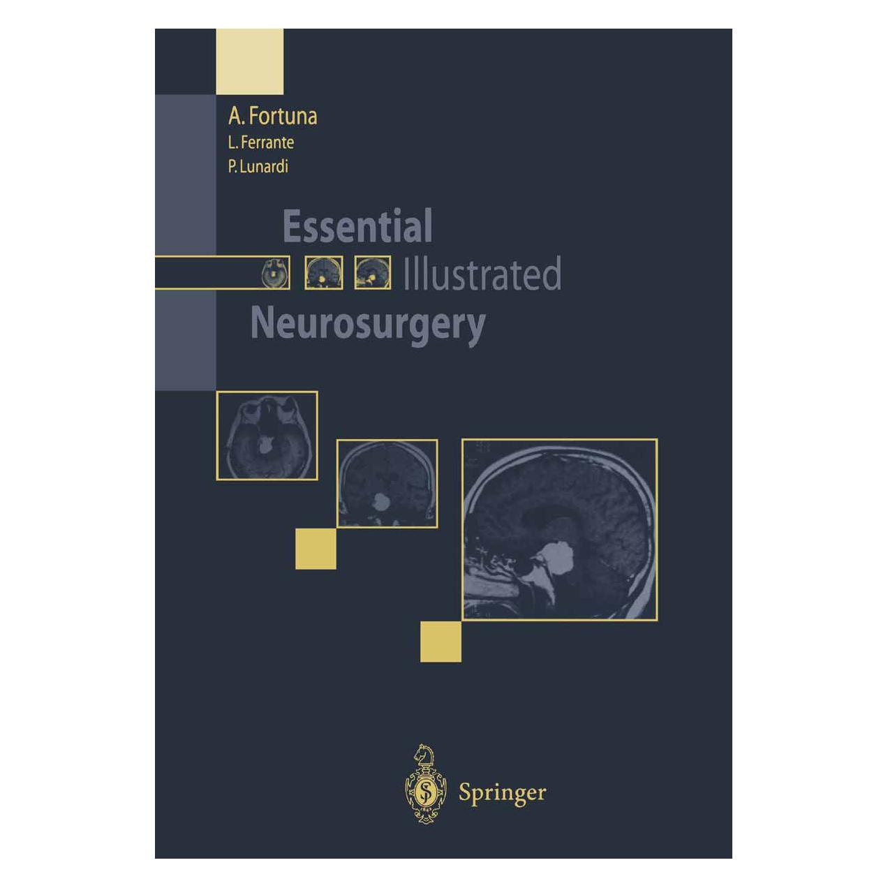 Springer Essential Illustrated Neurosurgery (Englisch, Softcover, A. Fortuna, L. Ferrante, P. Lunardi) (55555537)