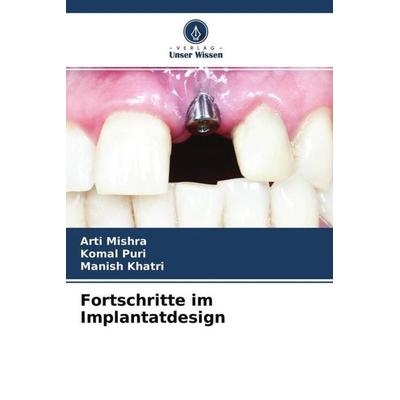 Fortschritte im Implantatdesign, Taschenbuch von Arti Mishra,Komal Puri,Manish Khatri, Verlag Unser Wissen, 978-620-4-70927-7