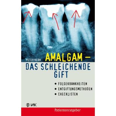 Amalgam - das schleichende Gift, Taschenbuch von Peter Kern, Vak, 978-3-86731-006-2