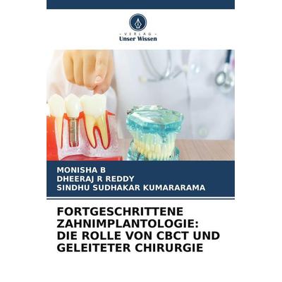 FORTGESCHRITTENE ZAHNIMPLANTOLOGIE: DIE ROLLE VON CBCT UND GELEITETER CHIRURGIE, Taschenbuch von Monisha B.,Dheeraj R. Reddy,Sindhu Sudhakar