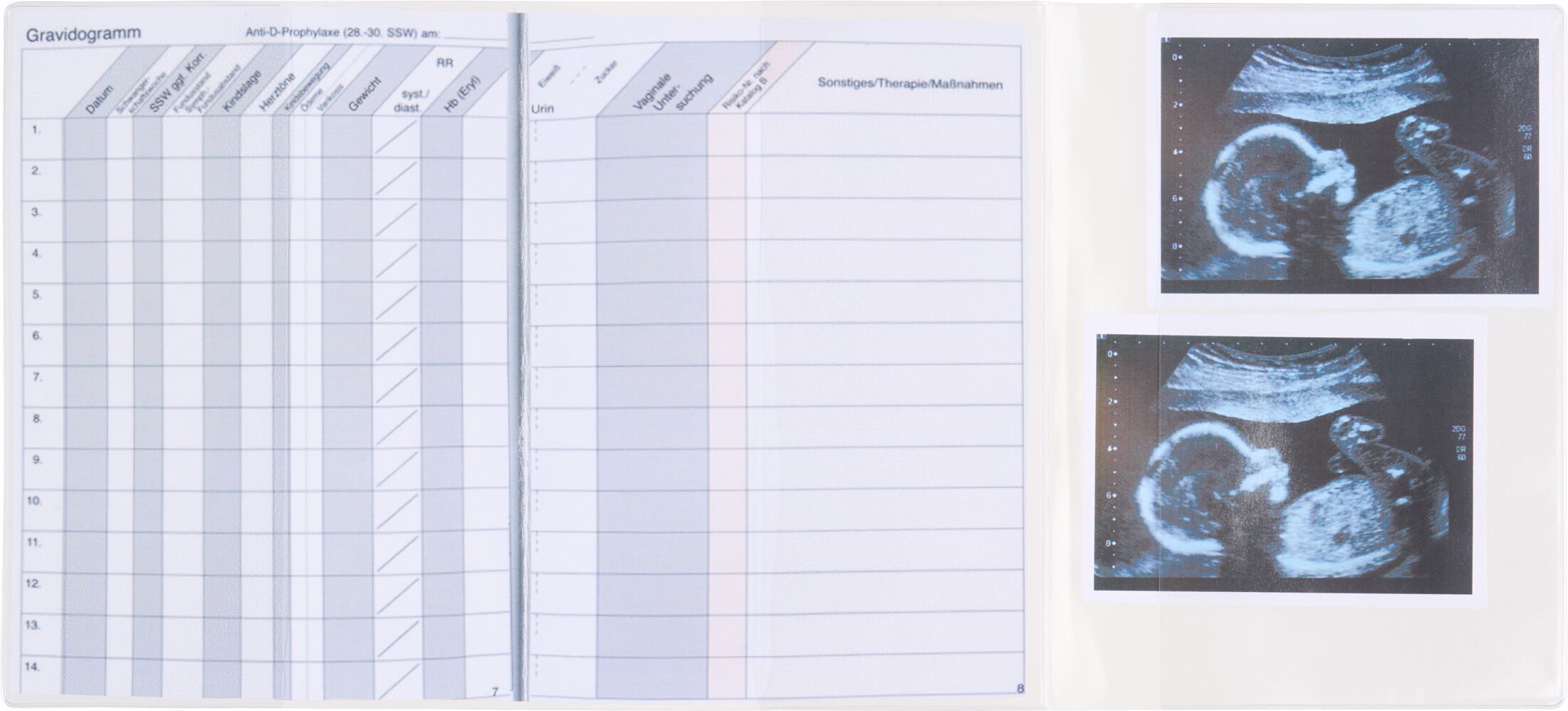 SPRINTIS 100 Unidades - Fundas para cartillas de embarazo de 180 x 390 mm, transparentes, PVC blando