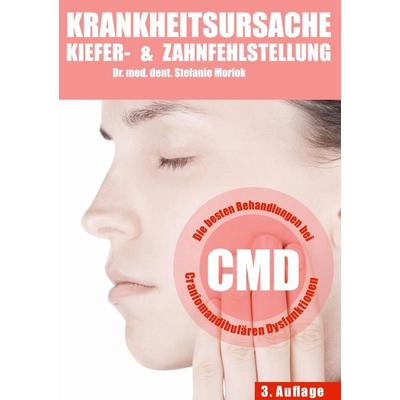 Krankheitsursache Kiefer- & Zahnfehlstellung, Gebundene Ausgabe von Stefanie Morlok, BoD - Books on Demand, 978-3-907743-06-5