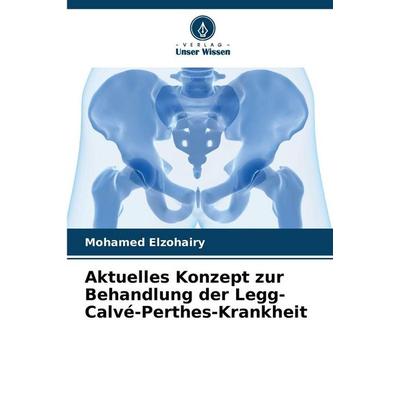 Aktuelles Konzept zur Behandlung der Legg-Calvé-Perthes-Krankheit, Taschenbuch von Mohamed Elzohairy, Verlag Unser Wissen, 978-620-2-48333-9
