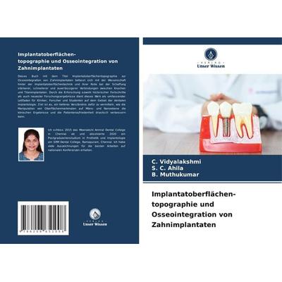 Implantatoberflächen- topographie und Osseointegration von Zahnimplantaten, Taschenbuch von C. Vidyalakshmi,S. C. Ahila,B. Muthukumar, Verlag Unser