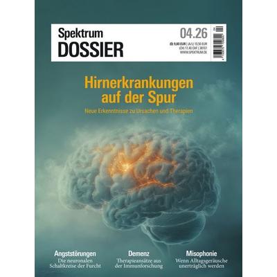 Spektrum Dossier 4/2026 Hirnerkrankungen auf der Spur, Taschenbuch von , Spektrum der Wissenschaft, 978-3-690-41072-4