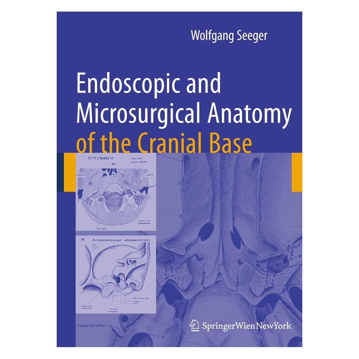 Springer Seeger,W.:Endoscopic and microsurgical (Englisch, Hardcover, Wolfgang Seeger) (9783211993194)