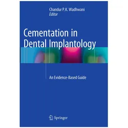 Cementation in Dental Implantology, Fachbücher von P K Wadhwani, Chandur P.K. Wadhwani