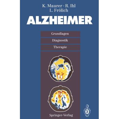 Alzheimer, Taschenbuch von K. Maurer,R. Ihl,L. Frölich, Springer Berlin, 978-3-540-56932-9