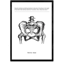 POSTER Anatomie Becken A3 Schwarzer Rahmen