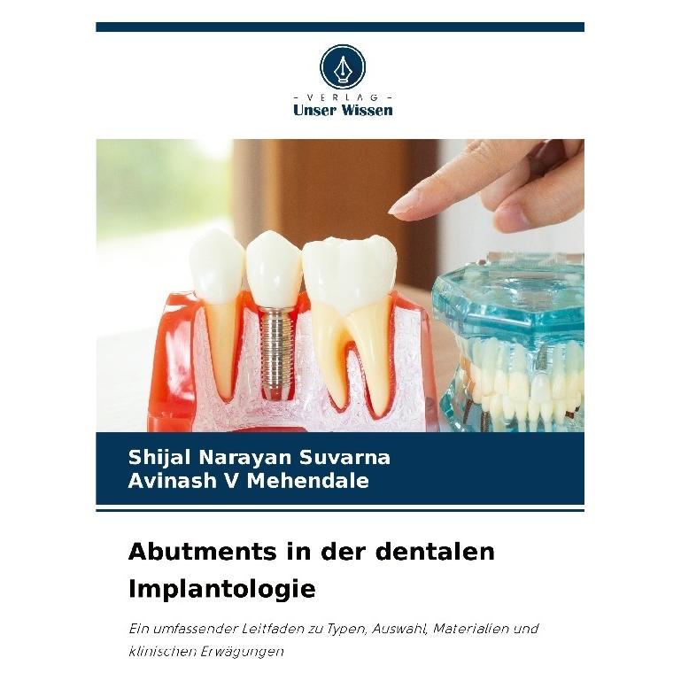 Bod Abutments in der dentalen Implantologie (Deutsch, Softcover, Avinash V Mehendale, Shijal Narayan Suvarna) (57203219)