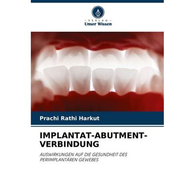 Implantat-Abutment-Verbindung, Taschenbuch von Prachi Rathi Harkut, Verlag Unser Wissen, 978-620-8-17427-9