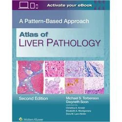 Atlas of Liver Pathology, Fachbücher von Michael Scott Torbenson, Gwyneth Soon