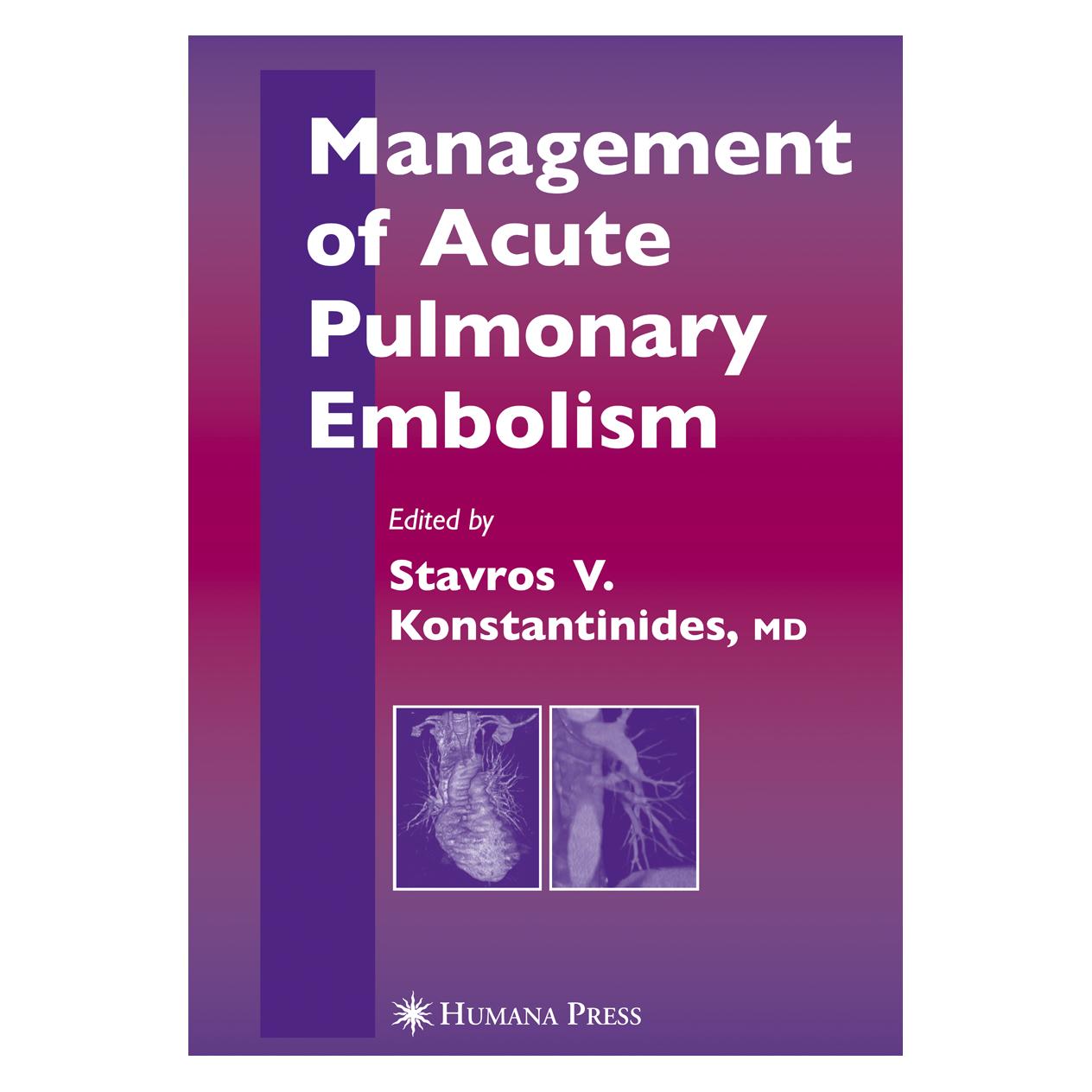 Springer Management of Acute Pulmonary Embolism (Englisch, Softcover) (9269941)