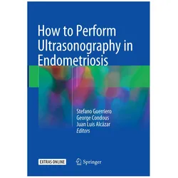 How to Perform Ultrasonography in Endometriosis, Fachbücher von Stefano Guerriero, George Condous, Juan Luis Alcázar