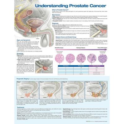 Understanding Prostate Cancer Anatomical Chart, von , Wolters Kluwer Health, 978-1-975192-37-2