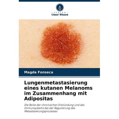 Lungenmetastasierung eines kutanen Melanoms im Zusammenhang mit Adipositas, Taschenbuch von Magda Fonseca, Verlag Unser Wissen, 978-620-6-90930-9