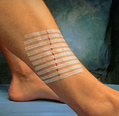 3M Health Care Steri-Strip Wundverschlussstreifen, steril, 6,0 x 38 mm (50x6 Stück) R1542