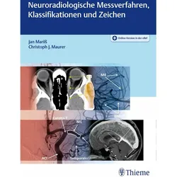 Neuroradiologische Messverfahren, Klassifikationen und Zeichen, Fachbücher von Jan Mariss, Christoph J. Maurer