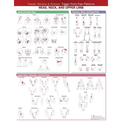 Travell, Simons & Simons' Trigger Point Pain Patterns Wall Chart, von , Ingram Publishers Services, 978-1-975183-84-4