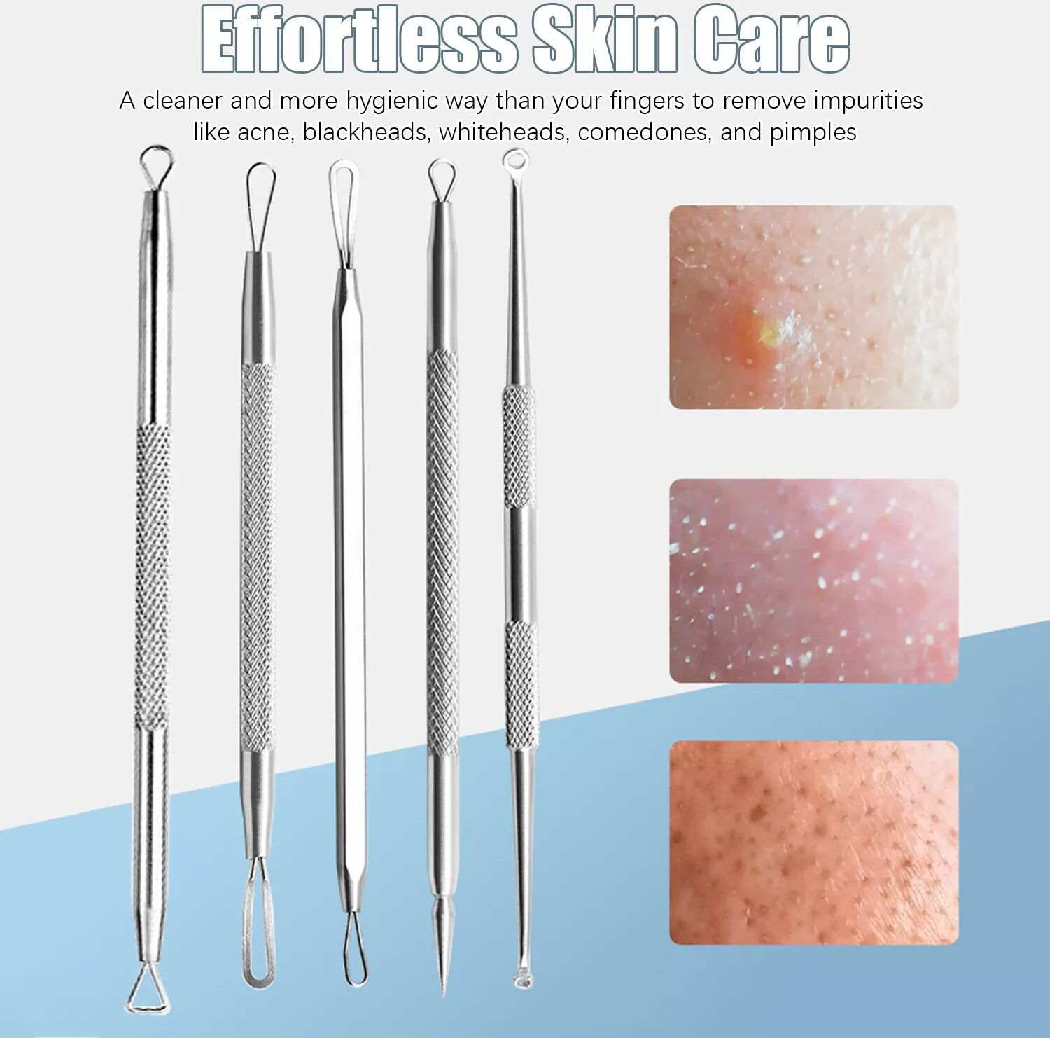 INF Dissolvant de points noirs 5 pièces, Popper de boutons, Kit de soins de la peau