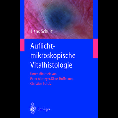 Auflichtmikroskopische Vitalhistologie, Taschenbuch von Hans Schulz, Springer Berlin, 978-3-642-62669-2