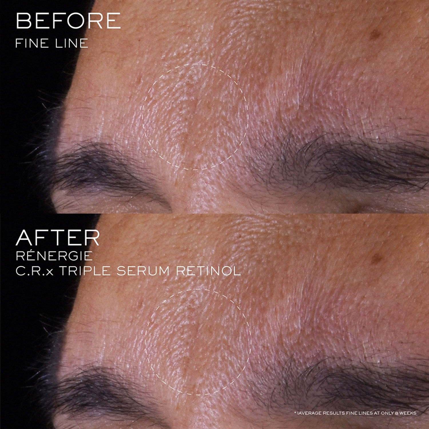 Lancome Renergie C.R.x. Triple Retinol Serum 20ml