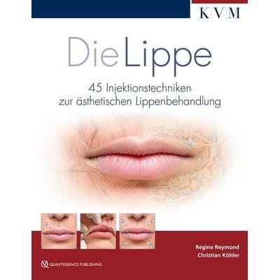 Die Lippe, Gebundene Ausgabe von Regine Reymond,Christian Köhler, KVM - Der Medizinverlag, 978-3-86867-402-6