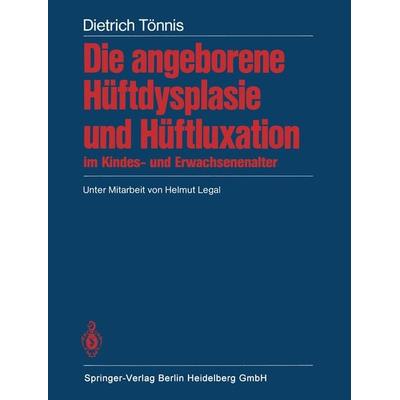 Die angeborene Hüftdysplasie und Hüftluxation im Kindes- und Erwachsenenalter, Taschenbuch von D. Tönnis, Springer Berlin, 978-3-662-06622-5