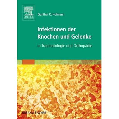 Infektionen der Knochen und Gelenke, Taschenbuch von Gunther O. Hofmann, Urban & Fischer in Elsevier, 978-3-437-31315-8
