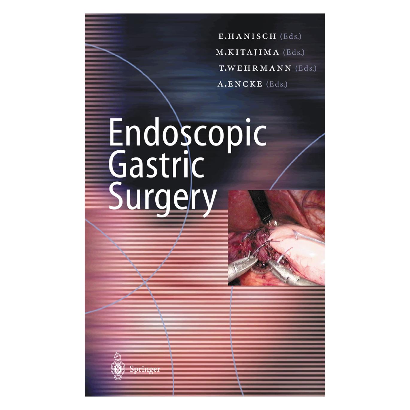 Springer Endoscopic Gastric Surgery (Englisch, Softcover, Encke A, Hanisch E, Kitajima M, Wehrmann T) (35146984)